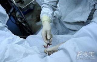 取卵视频,视频带你直观了解全过程