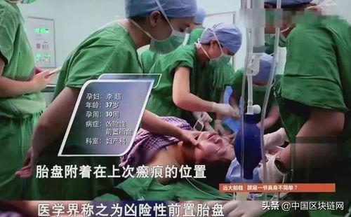 女生生孩子的视频,全程记录女性分娩瞬间