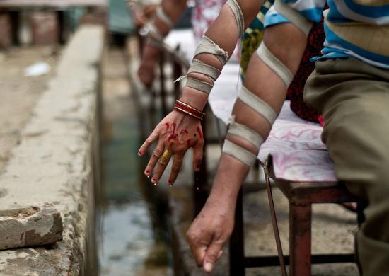 放血疗法视频,传统中医与现代视角下的神奇疗愈之道